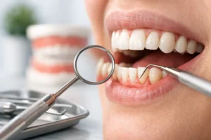 Guía del tratamiento de recesión gingival