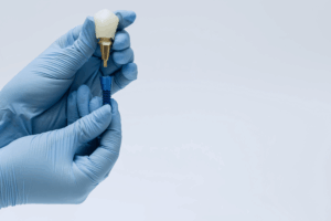 Implantes dentales cuándo son necesarios