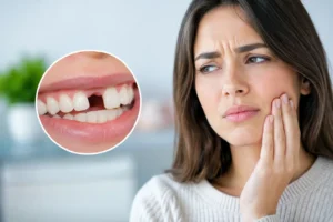 Ausencia dental y sus consecuencias en la salud